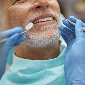 Nose-to-shoulder view of man with white beard about to undergo dental exam