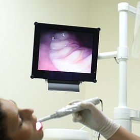 Intraoral photos on computer screen