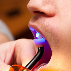 dental light