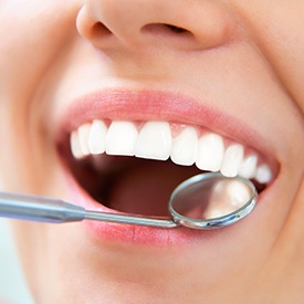 Closeup of smiel during dental checkup