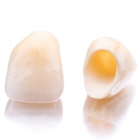 Tooth-colored dental crowns prior to placement