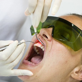 dental laser