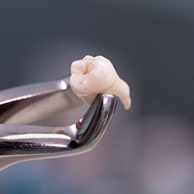 A pair of dental forceps holding an extracted tooth