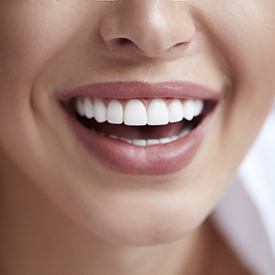 Woman with white teeth smiling