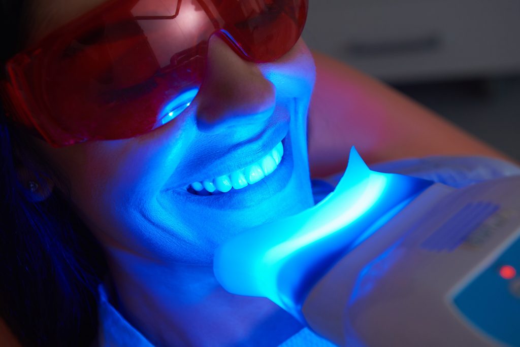 patient undergoing teeth whitening in Arnold