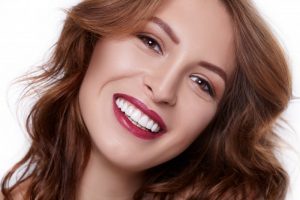 woman smiling with veneers